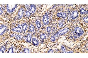 Detection of COL1a1 in Human Uterus Tissue using Monoclonal Antibody to Collagen Type I Alpha 1 (COL1a1)