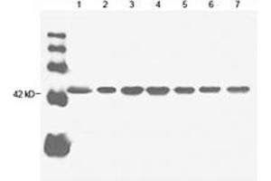 Image no. 1 for anti-Actin, beta (ACTB) antibody (ABIN2614157) (beta Actin anticorps)