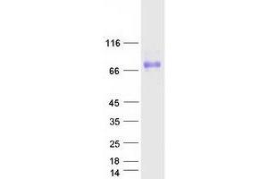 Validation with Western Blot