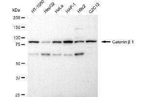 Western blotting analysis using catenin beta 1 antibody (ABIN7797930).