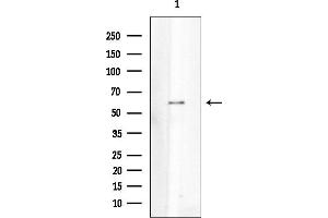 Western blot analysis of lysates from Mouse kidney, using PKM2 Mouse Monoclonal Antibody at 1/1000 dilution.