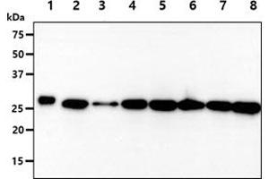 The recombinant protein (50ng) and cell lysates (40ug) were resolved by SDS-PAGE, transferred to PVDF membrane and probed with anti-human PGAM2 antibody (1:1000).