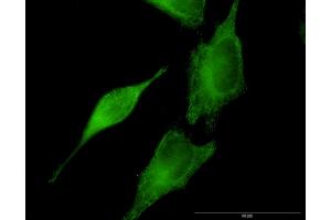 Immunofluorescence of monoclonal antibody to SEPT8 on HeLa cell. (Septin 8 anticorps  (AA 1-258))