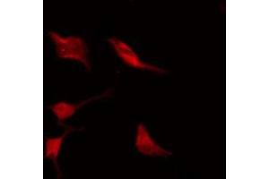 ABIN6275385 staining HeLa by IF/ICC.