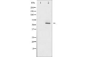 Western blot analysis of Akt2 phosphorylation expression in TNF-α treated A2780 whole cell lysates,The lane on the left is treated with the antigen-specific peptide. (AKT2 anticorps  (pSer474))