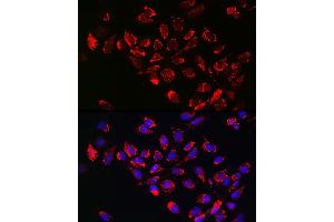 anti-Hexokinase 2 (HK2) (AA 1-120) antibody