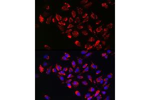 Immunofluorescence analysis of U-2 OS cells using [KO Validated] Hexokinase II Rabbit pAb (ABIN3021255, ABIN3021256, ABIN3021257 and ABIN6214088) at dilution of 1:100 (40x lens). (Hexokinase 2 anticorps  (AA 1-120))