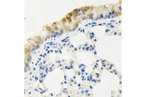 Immunohistochemical analysis of KIF2B staining in mouse lung formalin fixed paraffin embedded tissue section.