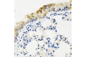 Immunohistochemical analysis of KIF2B staining in mouse lung formalin fixed paraffin embedded tissue section. (KIF2B anticorps)