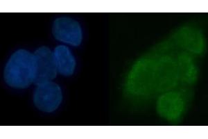 IF analysis of TRMT6 using anti-TRMT6 antibody (ABIN7602138). (TRMT6 anticorps  (AA 6-489))