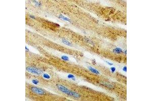 Immunohistochemical analysis of CARS staining in mouse heart formalin fixed paraffin embedded tissue section.