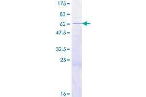 Image no. 1 for Protein Quaking (QKI) (AA 1-319) protein (GST tag) (ABIN1316999)