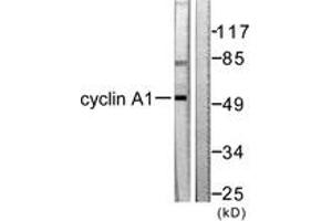 Western blot analysis of extracts from SKOV3 cells, using Cyclin A1 Antibody. (Cyclin A1 anticorps  (AA 411-460))