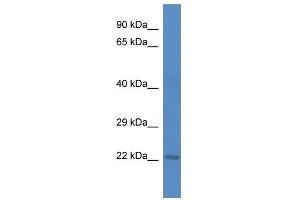 Western Blot showing 5730409E04Rik antibody used at a concentration of 1. (C1ORF216 anticorps  (C-Term))