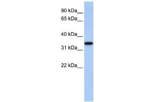 Western Blotting (WB) image for anti-ADP-Ribosyltransferase 4 (Dombrock Blood Group) (ART4) antibody (ABIN2458668) (ART4 anticorps)
