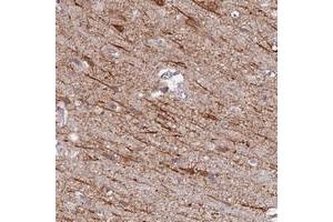 Immunohistochemical staining of human cerebral cortex with NEDD4 polyclonal antibody  shows distinct cytoplasmic positivity in subsets of neuronal cells. (NEDD4 anticorps)