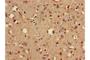 Immunohistochemistry of paraffin-embedded human brain tissue using ABIN7175463 at dilution of 1:100 (VTI1A anticorps  (AA 1-175))