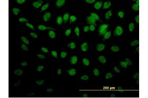 Immunofluorescence of monoclonal antibody to ROD1 on HeLa cell.
