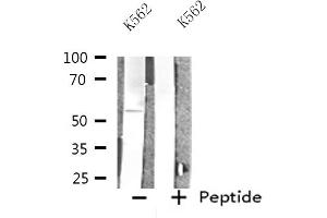 Western blot analysis of extracts from K562 cells, using INA antibody. (INA anticorps  (Internal Region))