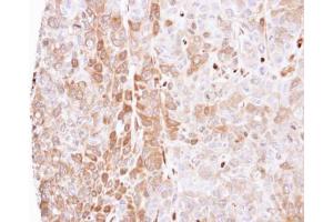 IHC-P Image Immunohistochemical analysis of paraffin-embedded FaDu xenograft, using LXN, antibody at 1:500 dilution.