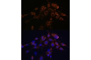 Immunofluorescence analysis of NIH-3T3 cells using DR5/TR/TNFRSF10B Rabbit mAb (ABIN7271062) at dilution of 1:100 (40x lens). (TNFRSF10B anticorps)