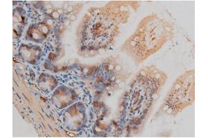 ABIN6267377 at 1/200 staining Mouse intestinal tissue sections by IHC-P.