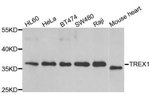 Western blot analysis of extracts of various cell lines, using TREX1 antibody. (TREX1 anticorps  (AA 1-270))