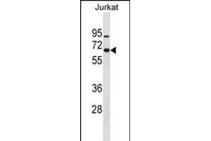 ZN Antibody (N-term) (ABIN1882022 and ABIN2838605) western blot analysis in Jurkat cell line lysates (35 μg/lane). (ZNF358 anticorps  (N-Term))