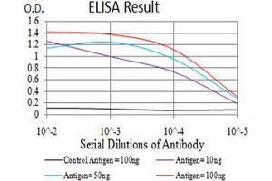 Black line: Control Antigen (100 ng),Purple line: Antigen (10 ng), Blue line: Antigen (50 ng), Red line:Antigen (100 ng) (beta 2 Adrenergic Receptor anticorps  (AA 302-413))