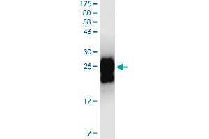 Western Blotting (WB) image for Cytotoxic T-Lymphocyte-Associated Protein 4 (CTLA4) (AA 37-161) protein (His-DYKDDDDK-Strep II Tag) (ABIN4369863)