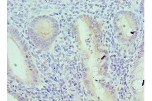 Immunohistochemistry of paraffin-embedded human epityphlon tissue using ABIN7156833 at dilution of 1:100 (IL18RAP anticorps  (AA 390-599))