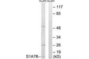 Western blot analysis of extracts from HuvEc cells, using S100A7L2 Antibody. (S100A7L2 anticorps  (AA 38-87))