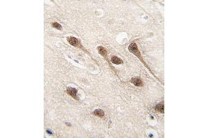 Formalin-fixed and paraffin-embedded human brain tissue reacted with RUNX1 Antibody  (ABIN650732 and ABIN2839428) , which was peroxidase-conjugated to the secondary antibody, followed by DAB staining.