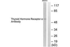 Western blot analysis of extracts from SKOV3 cells, using Thyroid Hormone Receptor alpha Antibody.