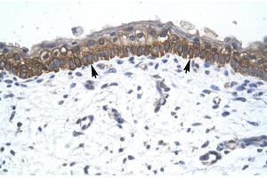 Human Skin; ZNF385 antibody - C-terminal region in Human Skin cells using Immunohistochemistry (ZNF385A anticorps  (C-Term))