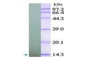 Image no. 2 for anti-Chemokine (C-X-C Motif) Ligand 10 (CXCL10) antibody (ABIN791563) (CXCL10 anticorps)