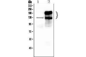 Western blot analysis of CEACAM5 using anti-CEACAM5 antibody (ABIN7601435). (CEACAM5 anticorps  (AA 35-650))