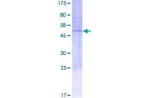 Image no. 1 for Calcium Channel, Voltage-Dependent, gamma Subunit 6 (CACNG6) (AA 1-260) protein (GST tag) (ABIN1347844)