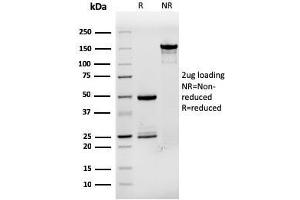 SDS-PAGE Analysis Purified TFF1/ps2 Mouse Monoclonal Antibody (rTFF1/1091).