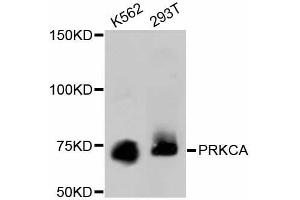 Western blot analysis of extracts of various cell lines, using PRKCA antibody (ABIN5997085). (PKC alpha anticorps)