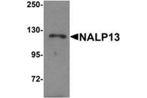 Western blot analysis of NALP13 in K562 cell lysate with NALP13 antibody at 1 μg/ml.
