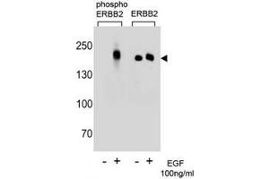 Western blot analysis of extracts from A431 cells, untreated or treated with EGF (100ng/ml) using p-ERBB2 antibody (left) or nonphos Ab (right) (ErbB2/Her2 anticorps  (pTyr1196))
