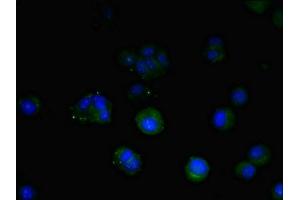 Immunofluorescent analysis of MCF-7 cells using ABIN7172947 at dilution of 1:100 and Alexa Fluor 488-congugated AffiniPure Goat Anti-Rabbit IgG(H+L) (TM9SF1 anticorps  (AA 28-230))