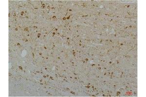 Immunohistochemical analysis of paraffin-embedded Rat Brain Tissue using Cav1. (CACNA1D anticorps)