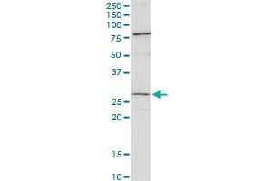 CFDP1 polyclonal antibody (A01).