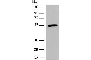 Western blot analysis of Human heart tissue lysate using CIR1 Polyclonal Antibody at dilution of 1:600 (CIR1 anticorps)