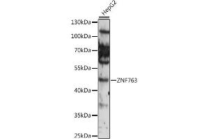 Western blot analysis of extracts of various cell lines, using ZNF763 antibody (ABIN7271529) at 1:1000 dilution. (ZNF763 anticorps  (AA 315-370))