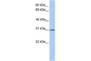 WB Suggested Anti-SURF4 Antibody Titration:  0. (Surfeit 4 anticorps  (N-Term))