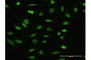 Immunofluorescence of purified MaxPab antibody to NFATC2IP on HeLa cell.