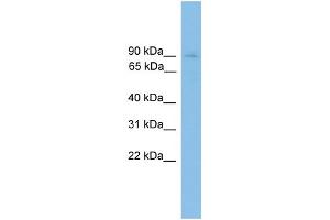 WB Suggested Anti-HNRNPU Antibody Titration:  0. (HNRNPU anticorps  (C-Term))